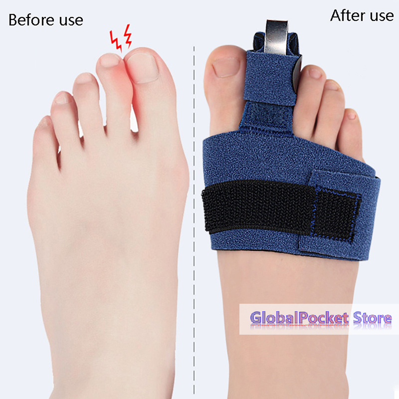 1Pcs Toe Corrector Toe Fractur – Ankle Brace Sock recenzja i cena